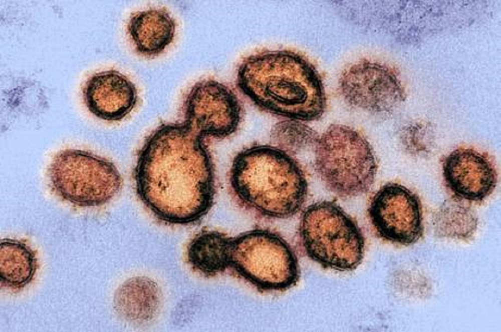 Farmacêutica Americana diz ter encontrado anticorpo que protege 100% do Coronavírus