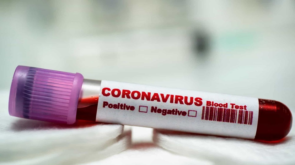 Porto Velho tem 15 óbitos por Covid-19 em 24h, 555 novos casos, 59.526 casos totais, 52.214 curados. Semusa informa 1.496 e Sesau informa 1.479 mortes totais na capital